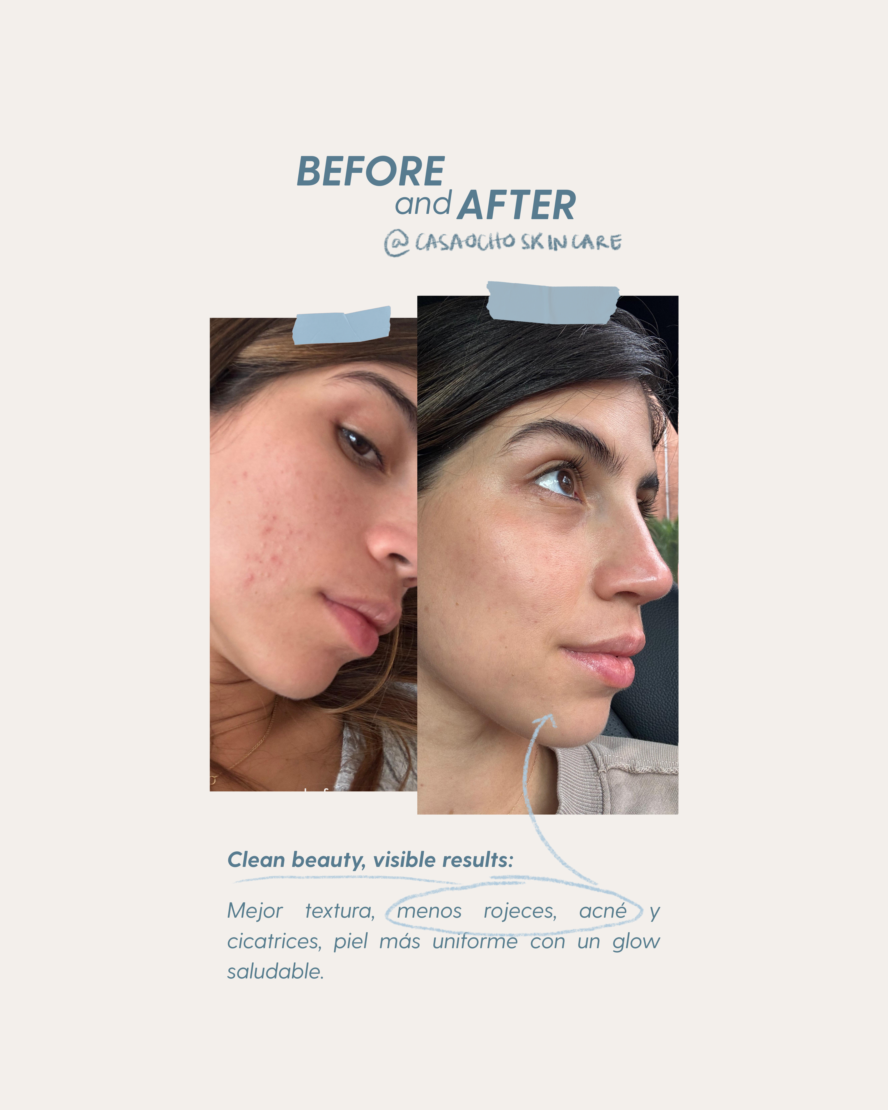 NATURAL TOUCH Limpiador Suave